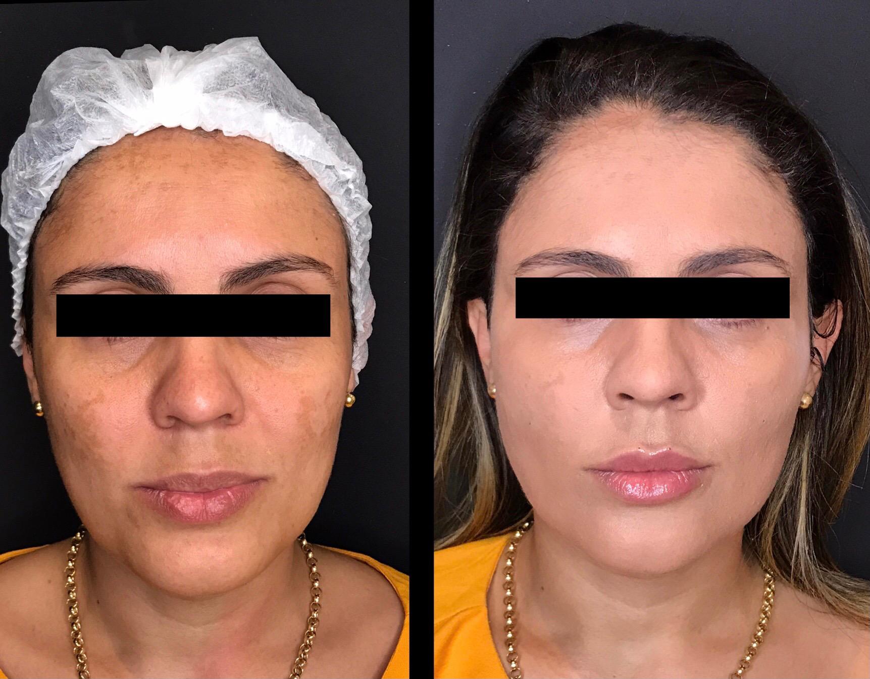 WhatsApp Image 2025-06-30 at 11.28.42 AM